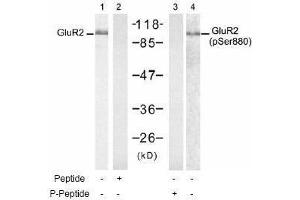 Image no. 1 for anti-Glutamate Receptor, Ionotropic, AMPA 2 (GRIA2) (pSer880) antibody (ABIN197062) (GRIA2 antibody  (pSer880))