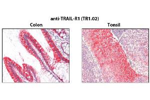 Immunohistochemistry detection of endogenous TRAIL-R1 in paraffin-embedded human carcinoma tissues (colon, tonsil) using mAb to TRAIL-R1 (TR1. (TNFRSF10A antibody)