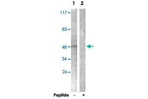 Western blot analysis of extracts from NIH/3T3 cells, using KCNJ3 polyclonal antibody . (KCNJ3 antibody  (Ser185))