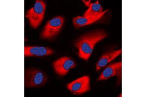Immunofluorescent analysis of PKC zeta staining in HeLa cells. (PKC zeta antibody  (C-Term))