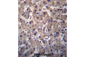 SULT1A3/SULT1A4 Antibody (N-term) immunohistochemistry analysis in formalin fixed and paraffin embedded human liver tissue followed by peroxidase conjugation of the secondary antibody and DAB staining. (SULT1C3 antibody  (C-Term, N-Term))
