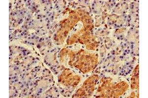 Immunohistochemistry of paraffin-embedded human pancreatic tissue using ABIN7167270 at dilution of 1:100 (RAB27A antibody  (AA 2-221))
