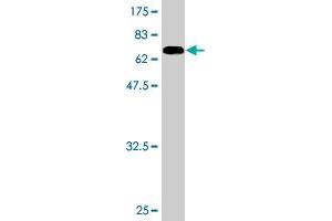 Western Blot detection against Immunogen (73. (PKNOX1 antibody  (AA 1-436))