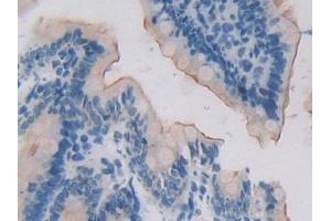 Detection of 15-LO-2 in Rat Small intestine Tissue using Polyclonal Antibody to 15-Lipoxygenase-2 (15-LO-2) (ALOX15B antibody  (AA 349-633))