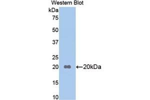 Detection of Recombinant APOB, Mouse using Polyclonal Antibody to Apolipoprotein B (APOB) (APOB antibody  (AA 3360-3526))