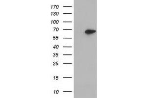Western Blotting (WB) image for anti-Epoxide Hydrolase 2, Cytoplasmic (EPHX2) antibody (ABIN1500856)