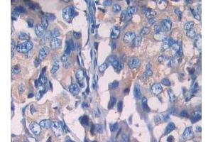 Used in DAB staining on fromalin fixed paraffin- embedded prostate gland tissue (SIGIRR antibody  (AA 1-118))