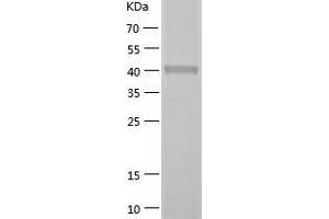 SH3GLB2 Protein (AA 1-395) (His tag)