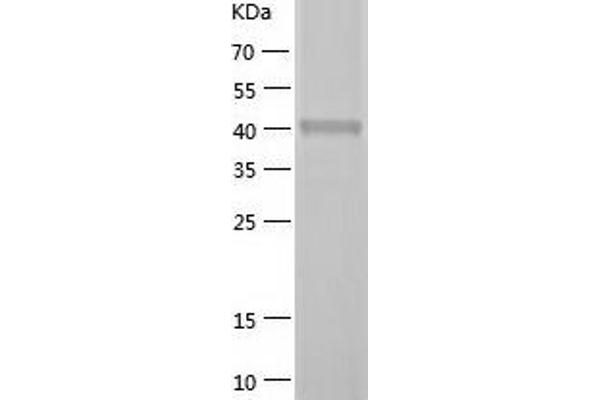 SH3GLB2 Protein (AA 1-395) (His tag)