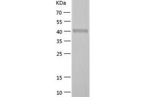 Western Blotting (WB) image for SH3-Domain GRB2-Like Endophilin B2 (SH3GLB2) (AA 1-395) protein (His tag) (ABIN7289003) (SH3GLB2 Protein (AA 1-395) (His tag))