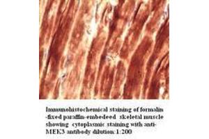 Image no. 1 for anti-Mitogen-Activated Protein Kinase Kinase 3 (MAP2K3) antibody (ABIN790902) (MAP2K3 antibody)