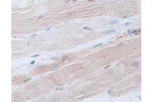 Immunohistochemical staining of formalin-fixed paraffin-embedded human skeletal muscle tissue showing cytoplasmic staining with ACTRT2 polyclonal antibody  at 1 : 100 dilution. (ACTRT2 antibody  (C-Term))