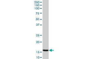 AGR2 monoclonal antibody (M01A), clone 1E5. (AGR2 antibody  (AA 1-175))