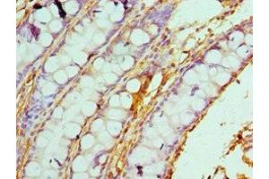 Immunohistochemistry of paraffin-embedded human colon tissue using ABIN7146462 at dilution of 1:100 (Caldesmon antibody  (AA 1-240))