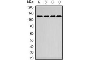 Western blot analysis of SMARCAD1 expression in A549 (A), HepG2 (B), mouse kidney (C), mouse lung (D) whole cell lysates. (SMARCAD1 antibody)