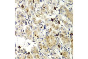 Immunohistochemistry (IHC) image for anti-Matrix Metallopeptidase 9 (Gelatinase B, 92kDa Gelatinase, 92kDa Type IV Collagenase) (MMP9) (AA 538-707) antibody (ABIN3022900) (MMP 9 antibody  (AA 538-707))