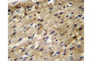 ABCD2 antibody immunohistochemistry analysis in formalin fixed and paraffin embedded human heart tissue. (CCL17 antibody  (AA 553-582))