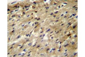 ABCD2 antibody immunohistochemistry analysis in formalin fixed and paraffin embedded human heart tissue.