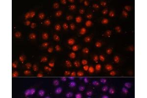 Immunofluorescence analysis of HeLa cells using TFEB Polyclonal Antibody at dilution of 1:100. (TFEB antibody)