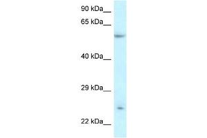 WB Suggested Anti-DERL3 Antibody Titration:  0. (Derlin-3 antibody  (Middle Region))