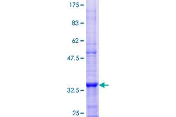 SOAT1 Protein (AA 249-321) (GST tag)