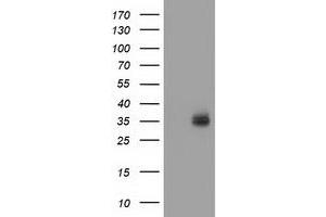 HEK293T cells were transfected with the pCMV6-ENTRY control (Left lane) or pCMV6-ENTRY VSIG2 (Right lane) cDNA for 48 hrs and lysed. (VSIG2 antibody)