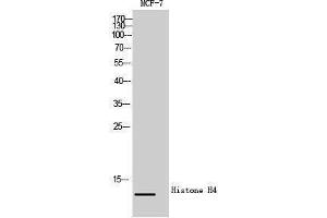 Western Blotting (WB) image for anti-Histone H4 (Lys310) antibody (ABIN3180095) (Histone H4 antibody  (Lys310))