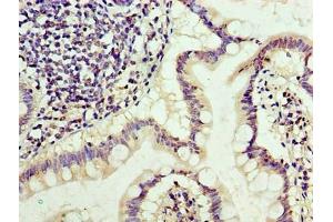 Immunohistochemistry of paraffin-embedded human small intestine tissue using ABIN7171285 at dilution of 1:100 (TRBC1 antibody  (AA 1-176))