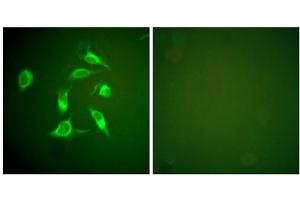 Immunofluorescence analysis of HeLa cells, using PDGFR alpha antibody. (PDGFRA antibody  (C-Term))