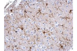 IHC-P Image Iba1 antibody detects Iba1 protein on mouse fore brain by immunohistochemical analysis. (Iba1 antibody  (C-Term))