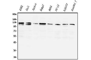 Western blot analysis of PI3K-gamma/PIK3CG using anti-PI3K-gamma/PIK3CG antibody (ABIN7601952).