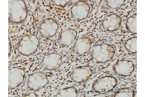 Immunoperoxidase of monoclonal antibody to LZTFL1 on formalin-fixed paraffin-embedded human colon. (LZTFL1 antibody  (AA 200-299))