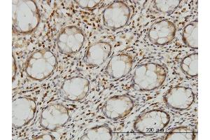 Immunoperoxidase of monoclonal antibody to LZTFL1 on formalin-fixed paraffin-embedded human colon. (LZTFL1 antibody  (AA 200-299))