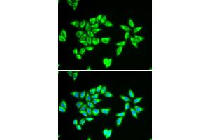 Immunofluorescence analysis of MCF-7 cell using PTRH2 antibody.