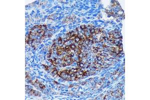 Immunohistochemistry of paraffin-embedded Rat ovary using MRPL30 Rabbit pAb (ABIN7268567) at dilution of 1:100 (40x lens). (MRPL30 antibody  (AA 1-161))