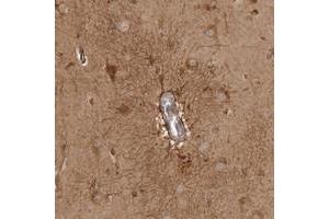 Immunohistochemical staining of human cerebral cortex with CAMSAP2 polyclonal antibody  shows distinct positivity in neuronal and glial cells at 1:200-1:500 dilution. (CAMSAP2 antibody)