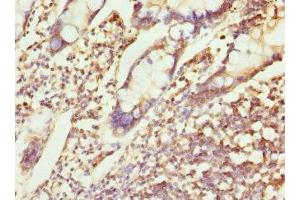 Immunohistochemistry of paraffin-embedded human small intestine tissue using ABIN7147524 at dilution of 1:100 (CHMP4B antibody  (AA 1-224))