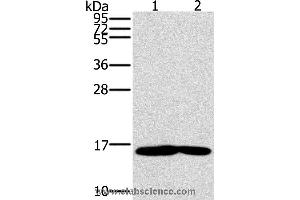 Western blot analysis of Mouse heart and muscle tissue, using MB Polyclonal Antibody at dilution of 1:600 (MTMR3 antibody)