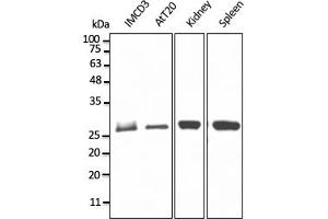 Western Blotting (WB) image for anti-RAB11B, Member RAS Oncogene Family (RAB11B) (C-Term) antibody (ABIN1440027) (RAB11B antibody  (C-Term))