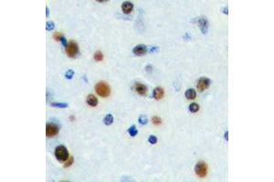 Immunohistochemical analysis of ANKRD30A staining in human brain formalin fixed paraffin embedded tissue section. (ANKRD30A antibody  (C-Term))