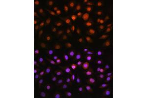 Immunofluorescence analysis of L929 cells using DDIT3/CHOP antibody (ABIN3020709, ABIN3020710, ABIN3020711, ABIN1512759 and ABIN6213685) at dilution of 1:100. (DDIT3 antibody  (C-Term))
