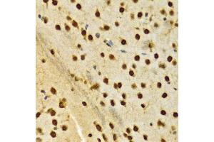 Immunohistochemistry (Paraffin-embedded Sections) (IHC (p)) image for anti-Heterogeneous Nuclear Ribonucleoprotein A2/B1 (HNRNPA2B1) (AA 1-180) antibody (ABIN3021593)