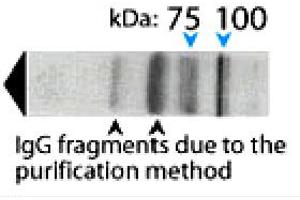 AP1B1 antibody  (AA 11-29)