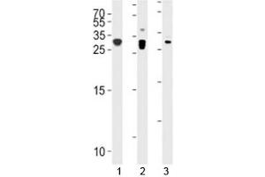 Western Blotting (WB) image for anti-Cyclin-Dependent Kinase Inhibitor 1B (p27, Kip1) (CDKN1B) (AA 1-30) antibody (ABIN3030624)