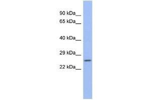 WB Suggested Anti-ZNRF1 Antibody Titration:  0.