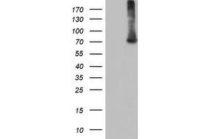 HEK293T cells were transfected with the pCMV6-ENTRY control (Left lane) or pCMV6-ENTRY EPM2AIP1 (Right lane) cDNA for 48 hrs and lysed. (EPM2AIP1 antibody)