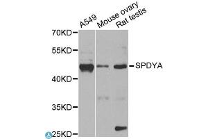 Western blot analysis of extracts of various cell lines, using SPDYA antibody (ABIN1874919) at 1:1000 dilution. (SPDYA antibody)