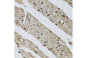 Immunohistochemistry of paraffin-embedded mouse heart using PHF1 antibody (ABIN5974685) at dilution of 1/100 (40x lens). (PHF1 antibody)