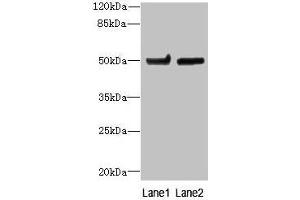 Western blot All lanes: TUBB6 antibody at 4 μg/mL Lane 1: Hela whole cell lysate Lane 2: MDA-MB-231 whole cell lysate Secondary Goat polyclonal to rabbit IgG at 1/10000 dilution Predicted band size: 50 kDa Observed band size: 50 kDa (TUBb6 antibody  (AA 1-446))