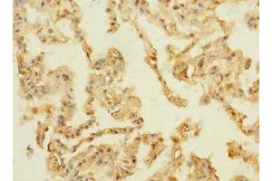 Immunohistochemistry of paraffin-embedded human lung tissue using ABIN7159336 at dilution of 1:100